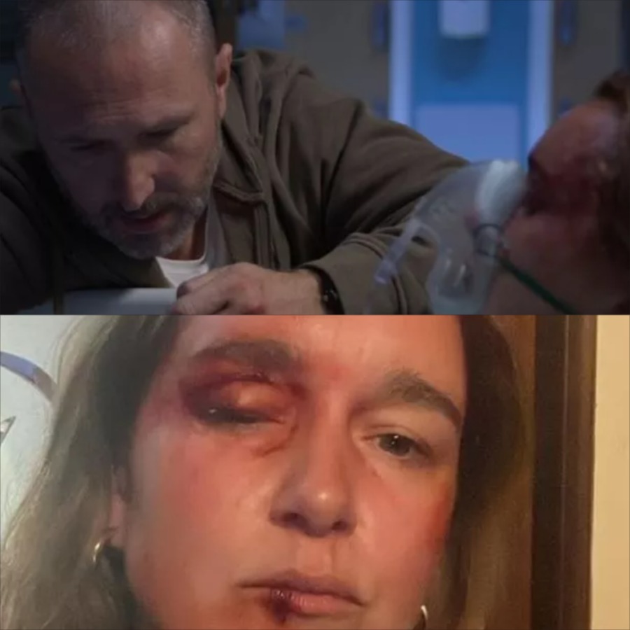 EastEnders Spoilers: Vicki regains consciousness in the hospital and murmurs, “I recall now… he didn’t simply kick me, he chuckled.” Will this evidence be adequate to incriminate Joel? – film.purextop.com