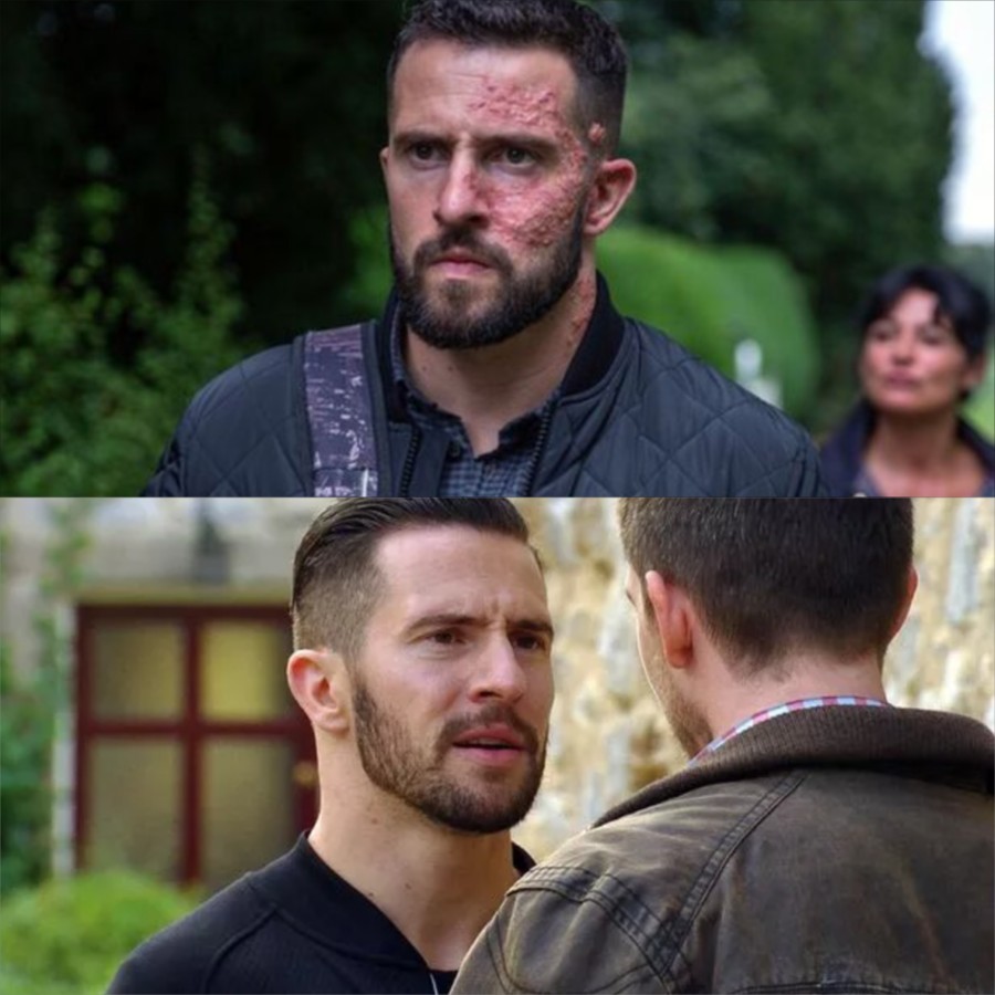 Emmerdale OMG: Off-screen, Ross Barton actor Mike Parr welcomes baby girl Suzie Rose—while on-screen Ross hides scandals. How will real life collide with the chaos of his character? –