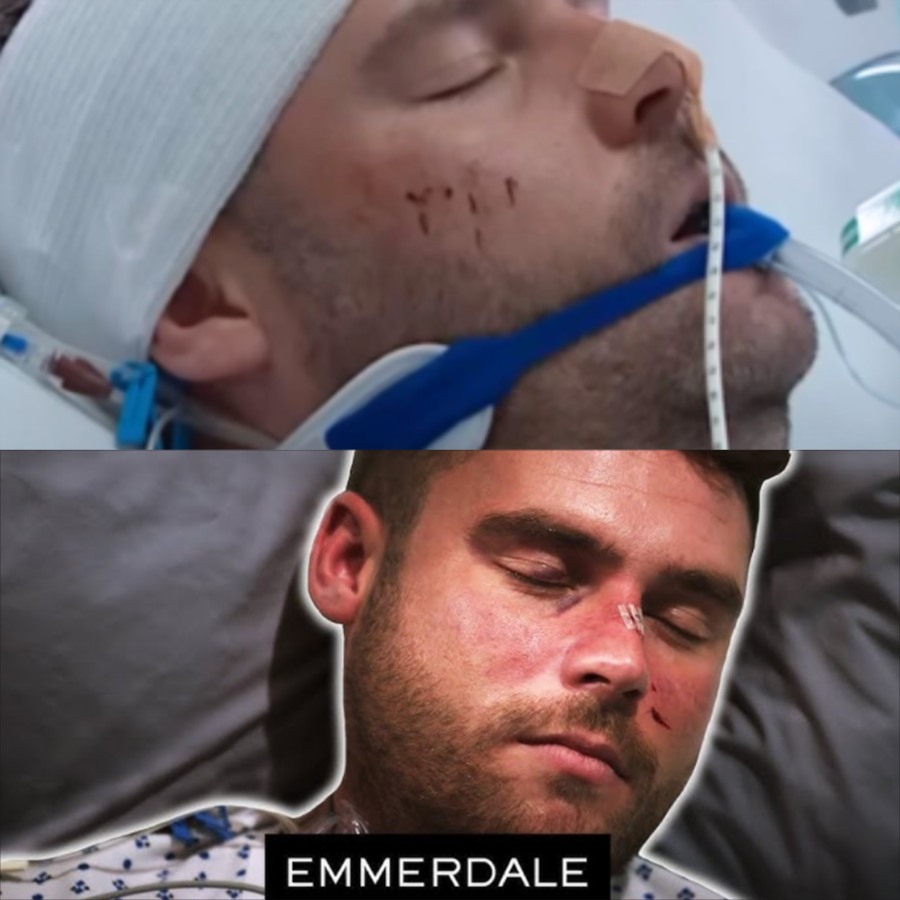 Emmerdale announces the next character to be “killed” is Aaron Dingle! But who will be the one to take him down?